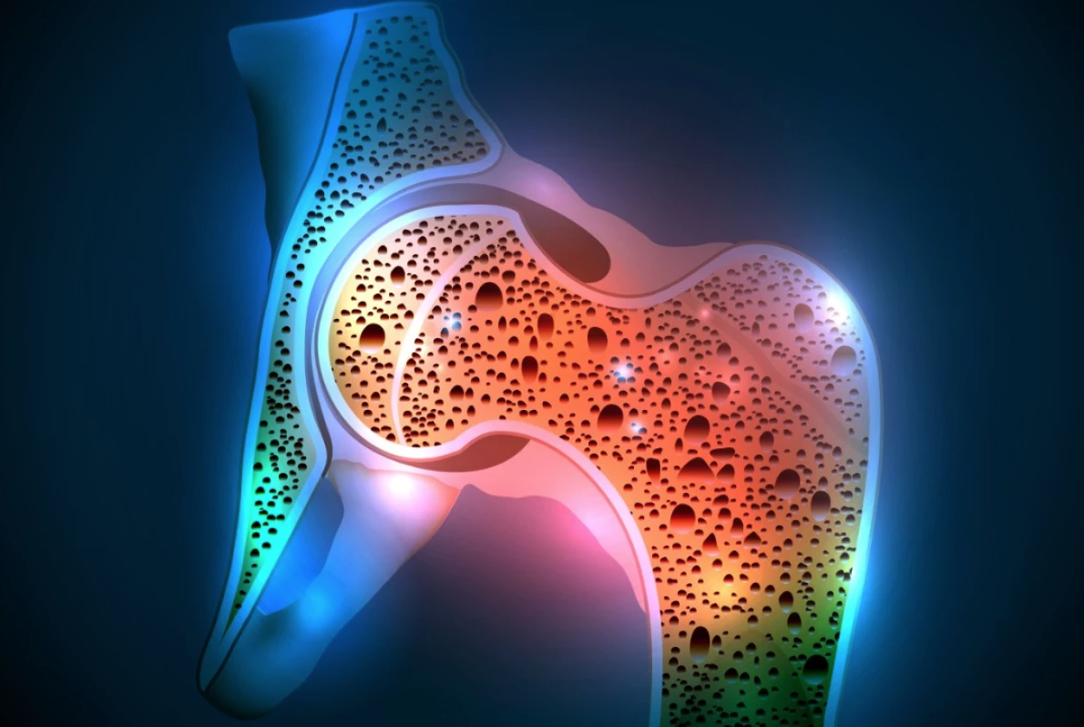 menachinone 7 osteoporosi